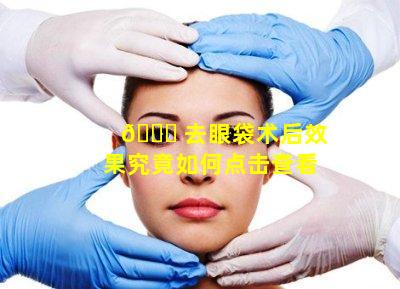 🍀 去眼袋术后效果究竟如何点击查看